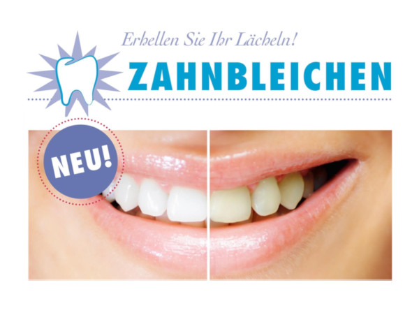 Zahnbleaching